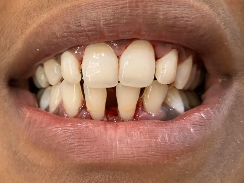 tanden poetsen India